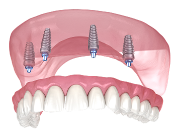 Teeth images